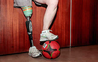 Marco du Plooy Prosthetics 3D-engineered prosthetic layouts, and specialized amputee walking rehabilitation.